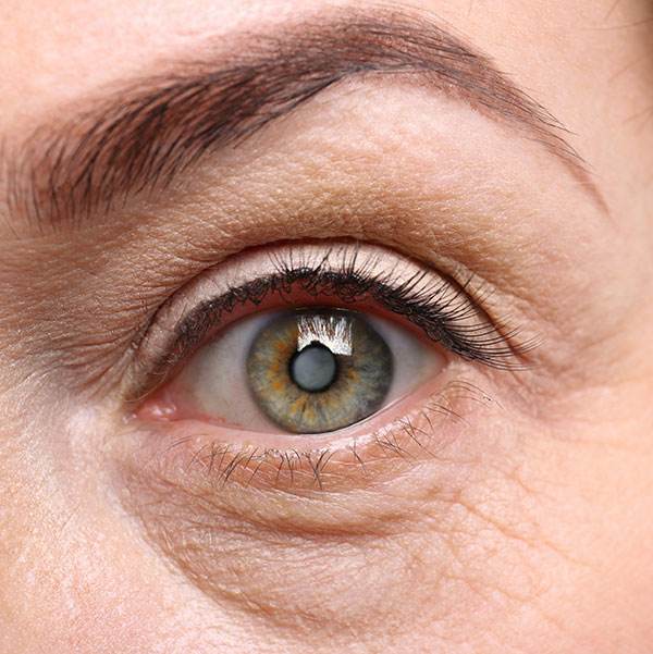 Outpatient eye surgery